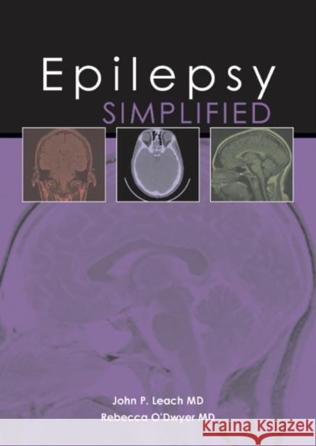 Epilepsy Simplified Leach 9781903378731 Tfm Publishing - książka