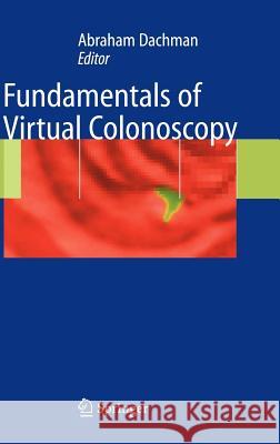 Fundamentals of Virtual Colonoscopy Abraham H. Dachman Abraham H. Dachman 9780387219127 Springer - książka
