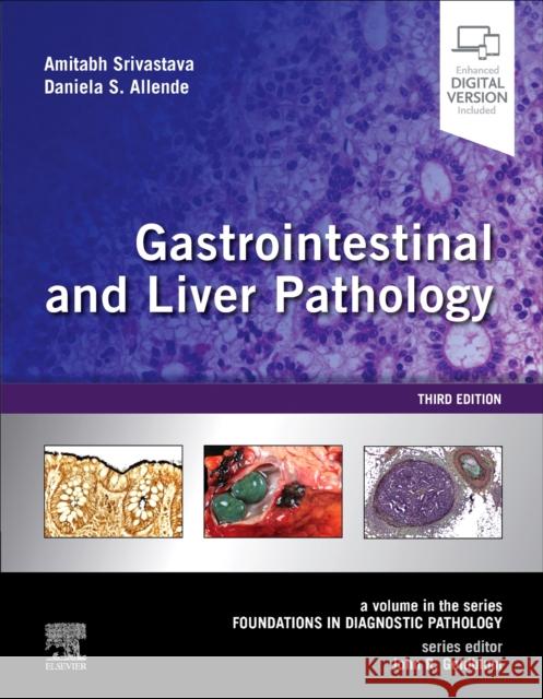 Gastrointestinal and Liver Pathology: A Volume in the Series: Foundations in Diagnostic Pathology Amitabh Srivastava Daniela S. Allende John R. Goldblum 9780323527941 Elsevier - książka