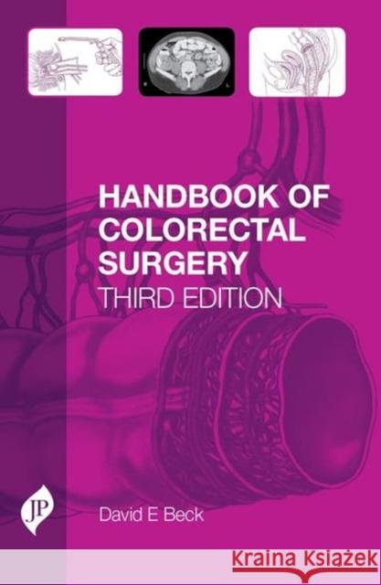 Handbook of Colorectal Surgery : Third Edition David Beck 9781907816208  - książka