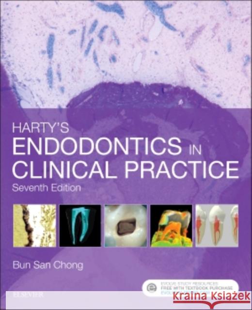 Harty's Endodontics in Clinical Practice Bun San Chong 9780702058356 Churchill Livingstone - książka