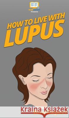 How To Live With Lupus: Your Step By Step Guide To Living With Lupus Howexpert 9781647585501 Howexpert - książka
