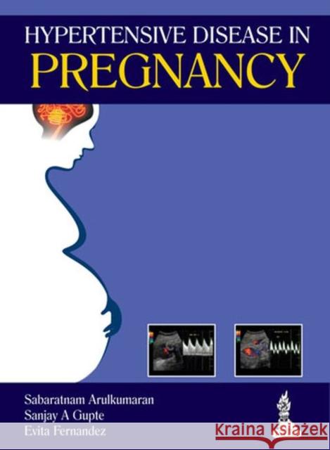 Hypertensive Disease in Pregnancy Sabaratnam Arulkumaran 9789350909515 JP Medical Ltd - książka