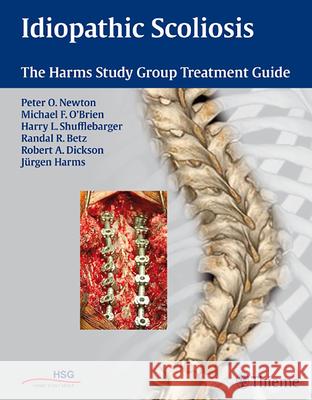 Idiopathic Scoliosis : The Harms Study Group Treatment Guide Peter Newton Michael O'Brien Harry Shufflebarger 9781604060249 Thieme Medical Publishers - książka
