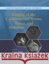 Imaging of the Cardiovascular System, Thorax, and Abdomen Luca Saba 9780367868918 CRC Press