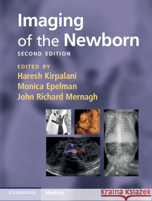 Imaging of the Newborn Haresh Kirpalani 9780521896269  - książka