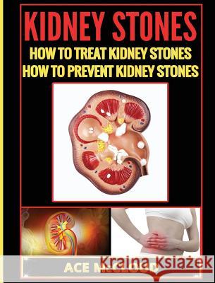 Kidney Stones: How To Treat Kidney Stones: How To Prevent Kidney Stones McCloud, Ace 9781640484214 Pro Mastery Publishing - książka