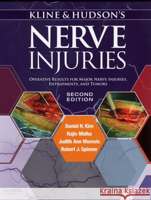 Kline and Hudson's Nerve Injuries: Operative Results for Major Nerve Injuries, Entrapments and Tumors Kim, Daniel H. 9780721695372 Saunders Book Company - książka