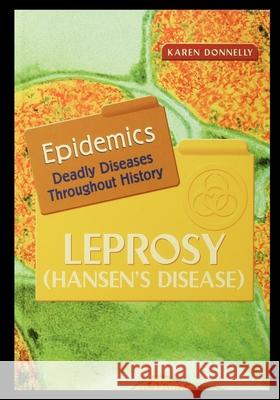 Leprosy: Hansen's Disease Karen Donnelly 9781435888098 Rosen Publishing Group - książka