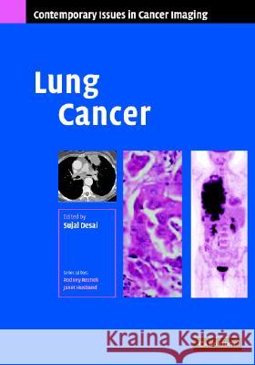 Lung Cancer Sujal R. Desai 9780521872027 Cambridge University Press - książka