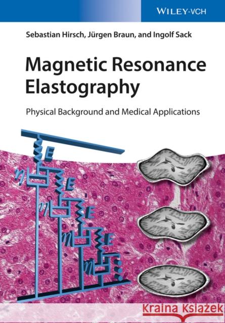 Magnetic Resonance Elastography: Physical Background and Medical Applications Hirsch, Sebastian 9783527340088 John Wiley & Sons - książka