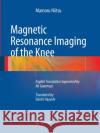 Magnetic Resonance Imaging of the Knee Mamoru Niitsu Ali Guermazi Daichi Hayashi 9783662520147 Springer