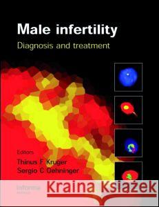 Male Infertility: Diagnosis and Treatment Oehninger, Sergio 9780415397421 Informa Healthcare - książka