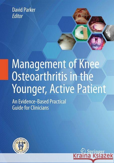 Management of Knee Osteoarthritis in the Younger, Active Patient: An Evidence-Based Practical Guide for Clinicians Parker, David 9783662485286 Springer - książka