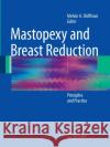 Mastopexy and Breast Reduction: Principles and Practice Shiffman, Melvin a. 9783662518571 Springer