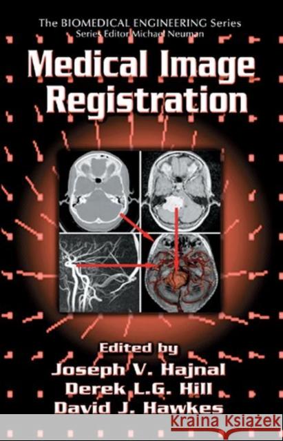 Medical Image Registration Joseph V. Hajnal Derek L. G. Hill David J. Hawkes 9780849300646 CRC Press - książka