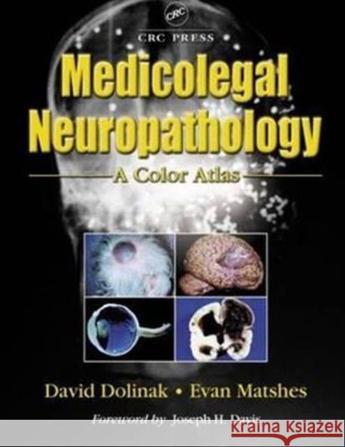 Medicolegal Neuropathology: A Color Atlas Evan W. Matshes David Dolinak 9780849313615 CRC Press - książka