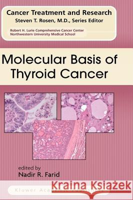 Molecular Basis of Thyroid Cancer Nadir R. Farid 9781402081064 Kluwer Academic Publishers - książka