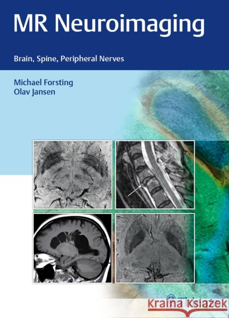 MR Neuroimaging: Brain, Spine, Peripheral Nerves Forsting, Michael 9783132026810 Tps - książka