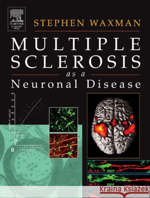 Multiple Sclerosis as a Neuronal Disease Waxman, Stephen 9780127387611 Academic Press - książka