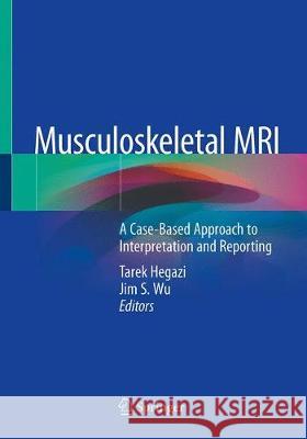 Musculoskeletal MRI: A Case-Based Approach to Interpretation and Reporting Hegazi, Tarek M. 9783030267766 Springer - książka