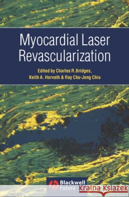 Myocardial Laser Revascularization Charles R. Bridges Keith A. Horvath Ray Chu-Jeng Chiu 9781405122108 Blackwell Futura - książka