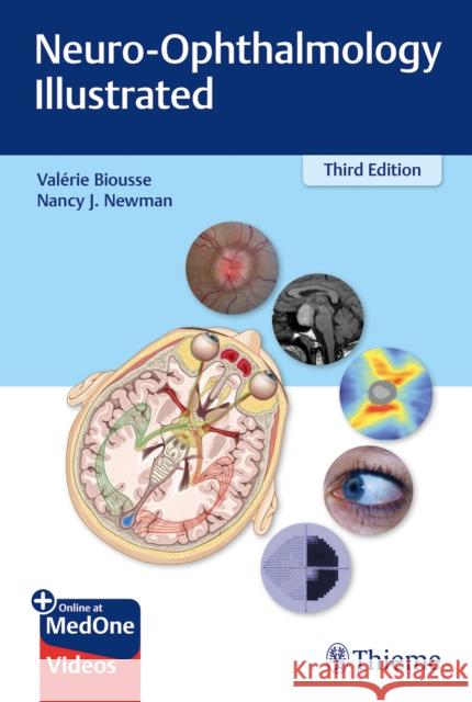 Neuro-Ophthalmology Illustrated Biousse, Valerie 9781684200740 Thieme Medical Publishers - książka