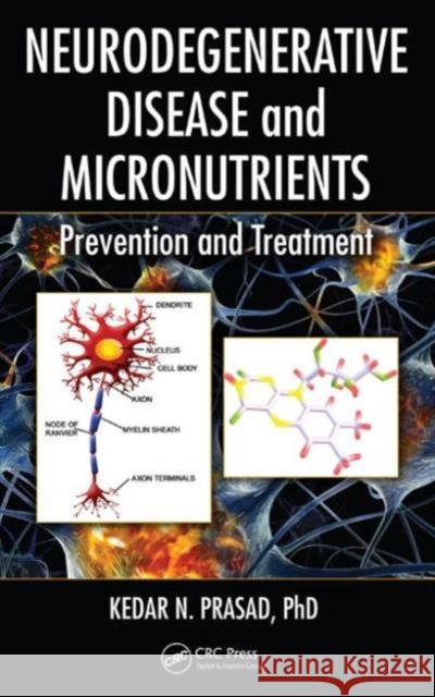 Neurodegenerative Disease and Micronutrients: Prevention and Treatment Kedar N. Prasad 9781482210477 CRC Press - książka