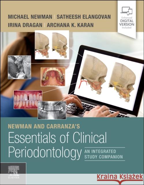 Newman and Carranza's Essentials of Clinical Periodontology: An Integrated Study Companion Michael G. Newman Irina Dragan Archana K. Karan 9780323754569 Elsevier - książka