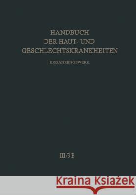 Nicht Entzündliche Dermatosen: Bösartige Geschwülste - Leukämie Fischer, H. 9783662011515 Springer - książka