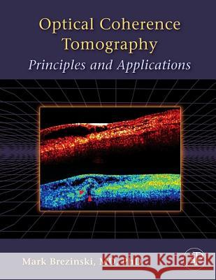 Optical Coherence Tomography: Principles and Applications Brezinski, Mark E. 9780121335700 Academic Press - książka