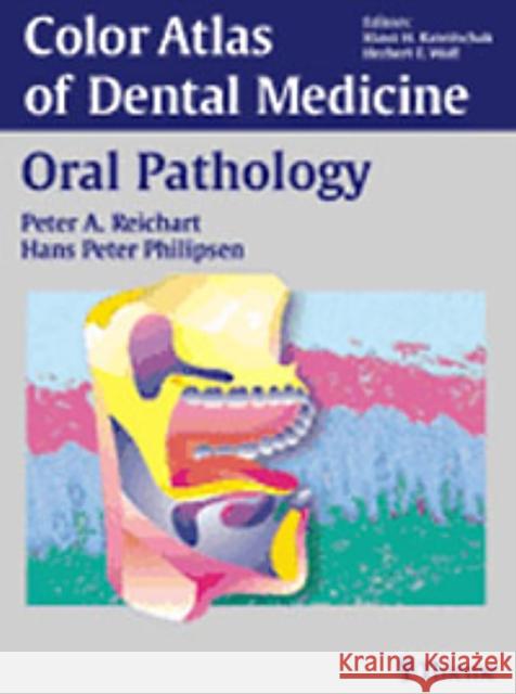 Oral Pathology P.A. Reichart H.Peter Philipsen Thomas Michael Hassell 9783131258816 Thieme Publishing Group - książka