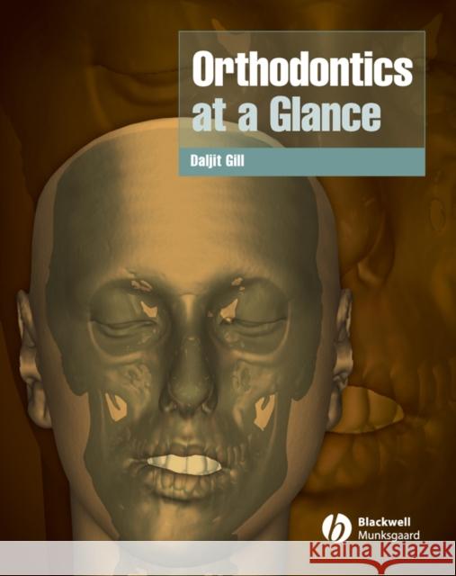 Orthodontics at a Glance  Gill 9781405127882  - książka