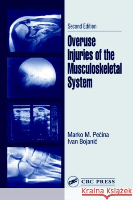 Overuse Injuries of the Musculoskeletal System Marko Pecina Ivan Bojanic 9780849314285 CRC Press - książka