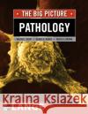 Pathology: The Big Picture William Kemp Walter L. Kemp 9780071477482 McGraw-Hill Medical Publishing