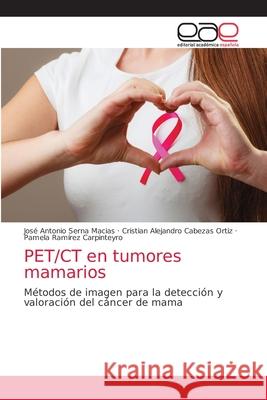 PET/CT en tumores mamarios Jos Sern Cristian Alejandro Cabeza Pamela Ram 9786203032208 Editorial Academica Espanola - książka
