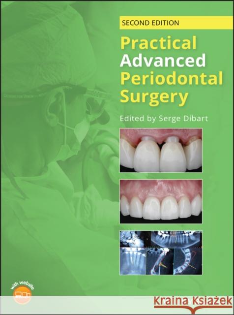 Practical Advanced Periodontal Surgery Serge Dibart 9781119196310 Wiley-Blackwell - książka