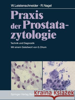 Praxis Der Prostatazytologie: Technik Und Diagnostik Leistenschneider, W. 9783662094167 Springer - książka