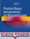 Prostate Biopsy Interpretation: An Illustrated Guide Rajal B. Shah Ming Zhou 9783662520093 Springer