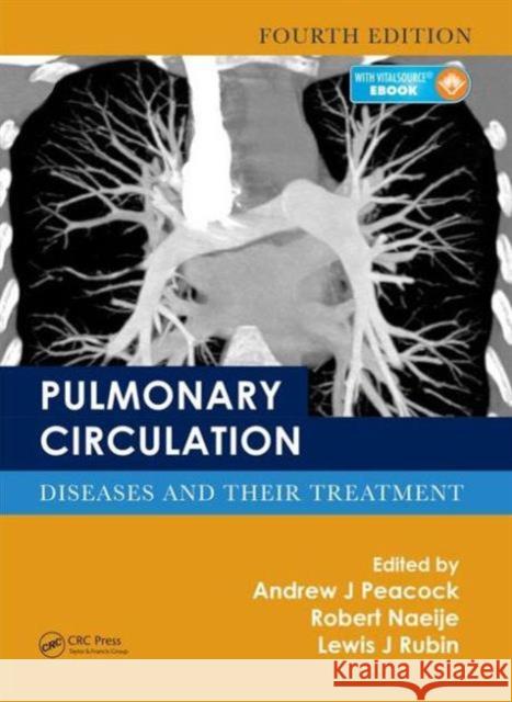 Pulmonary Circulation: Diseases and Their Treatment, Fourth Edition Andrew J. Peacock Robert Naeije Lewis J. Rubin 9781498719919 Taylor and Francis - książka