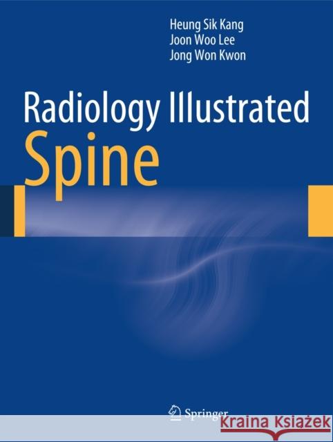 Radiology Illustrated: Spine Heung Sik Kang Joon Woo Lee Jong Won Kwon 9783642356285 Springer - książka