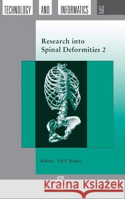 Research into Spinal Deformities 2: Proceedings of the 2nd Biannual Meeting of the International Research Society of Spinal Deformities I. A. F. Stokes, Peter Dangerfield 9789051994308 IOS Press - książka