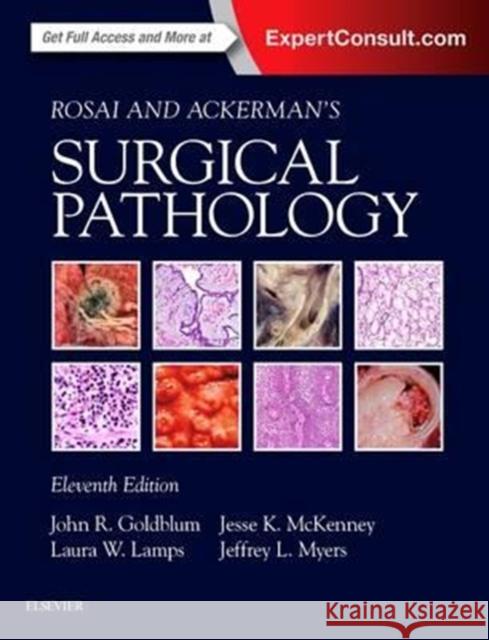 Rosai and Ackerman's Surgical Pathology - 2 Volume Set John R. Goldblum Laura W. Lamps Jesse McKenney 9780323263399 Elsevier - książka