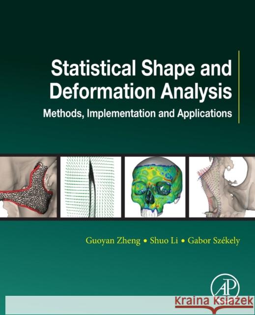 Statistical Shape and Deformation Analysis: Methods, Implementation and Applications Guoyan Zheng Shuo Li Gabor Szekely 9780128104934 Academic Press - książka