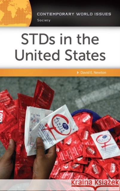 STDS in the United States: A Reference Handbook Newton, David 9781440858574 ABC-CLIO - książka