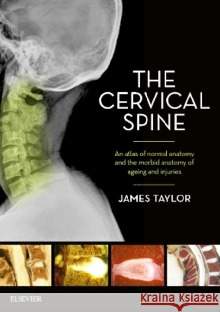 The Cervical Spine: An Atlas of Normal Anatomy and the Morbid Anatomy of Ageing and Injuries James Taylor 9780729542715 Elsevier - książka