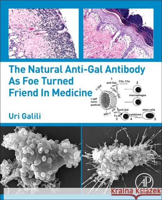The Natural Anti-Gal Antibody as Foe Turned Friend in Medicine Uri Galili 9780128133620 Academic Press - książka