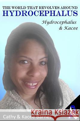 The World That Revolves Around Hydrocephalus: Hydrocephalus and Kacee Kacee Barnes Cathy Barnes 9781545125090 Createspace Independent Publishing Platform - książka