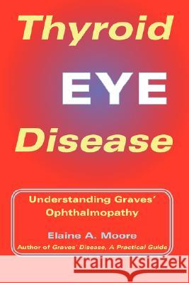 Thyroid Eye Disease: Understanding Graves' Opthalmopathy Elaine Moore 9781412009119 Trafford Publishing - książka