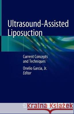 Ultrasound-Assisted Liposuction: Current Concepts and Techniques Garcia Jr, Onelio 9783030268749 Springer - książka